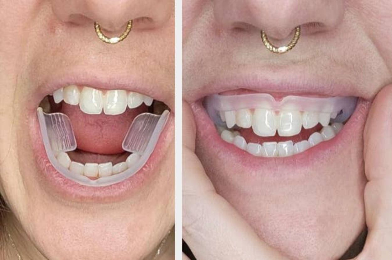 24 Products You’ve Probably Been Putting Off Buying, So Let’s Stop Procrastinating And Hit “Add To Cart”