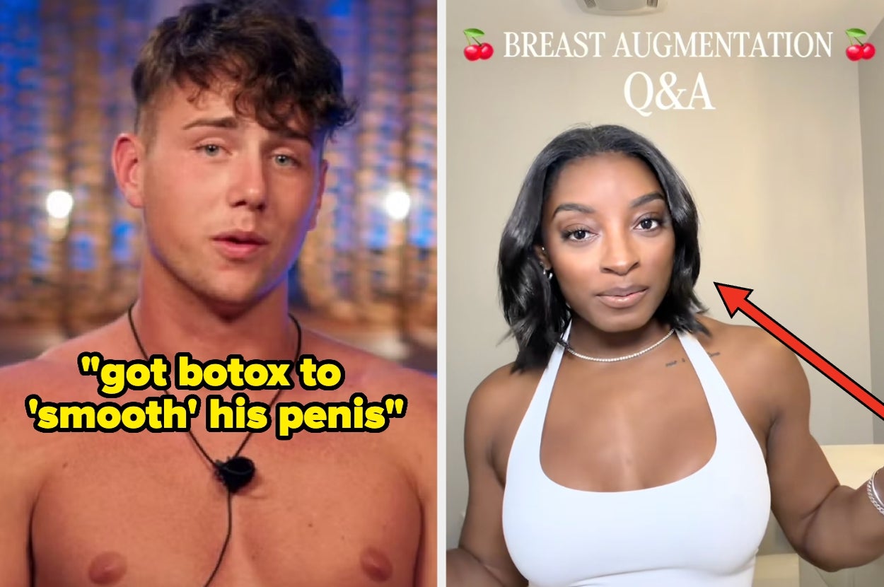 “I Know Some Great Doctors”: Famous People Got Candid About All The Plastic Surgery They’ve Gotten, And Wowwww