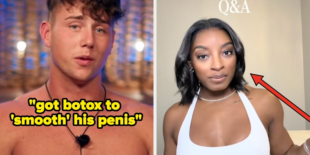 32 Famous People Talk Plastic Surgery