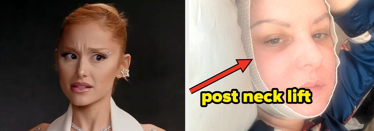 32 Famous People Straight-Up Admitted To All Their Plastic Surgery, And God, I Wish I Were Rich
