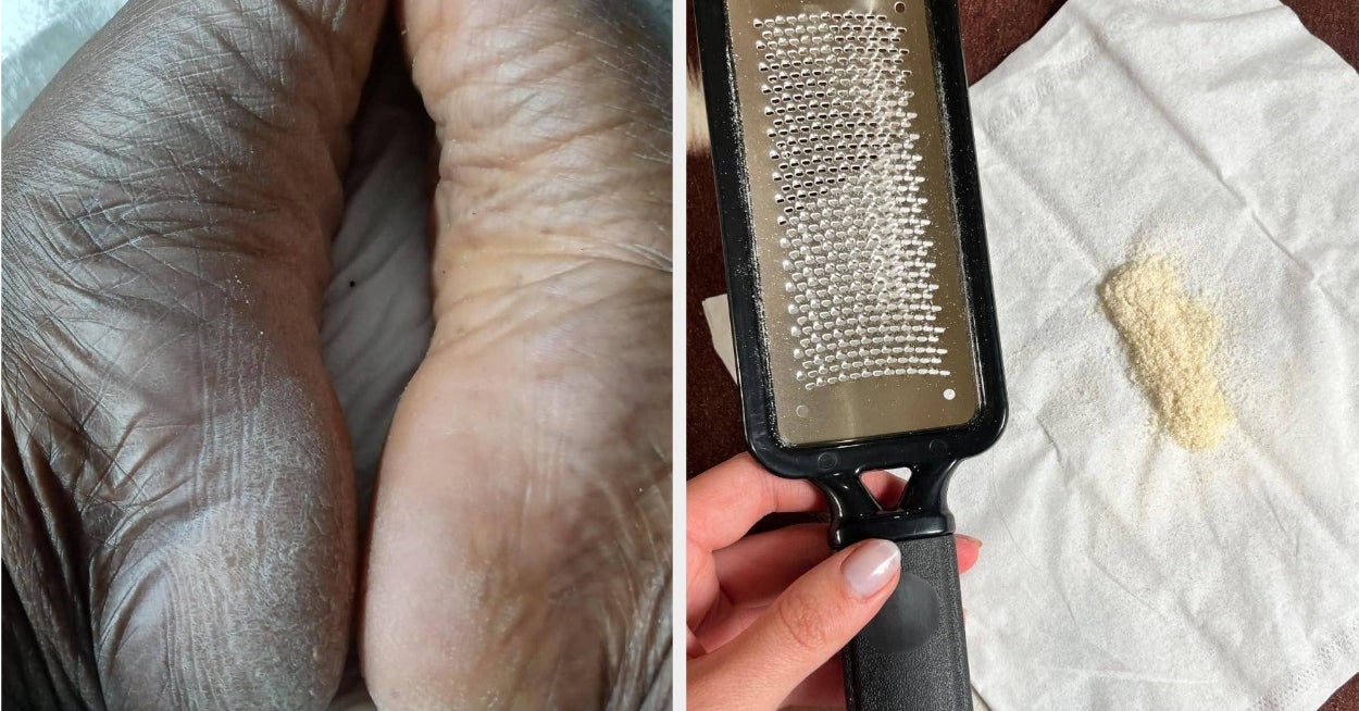 Step Up Your Foot Care Game With These 25 Products