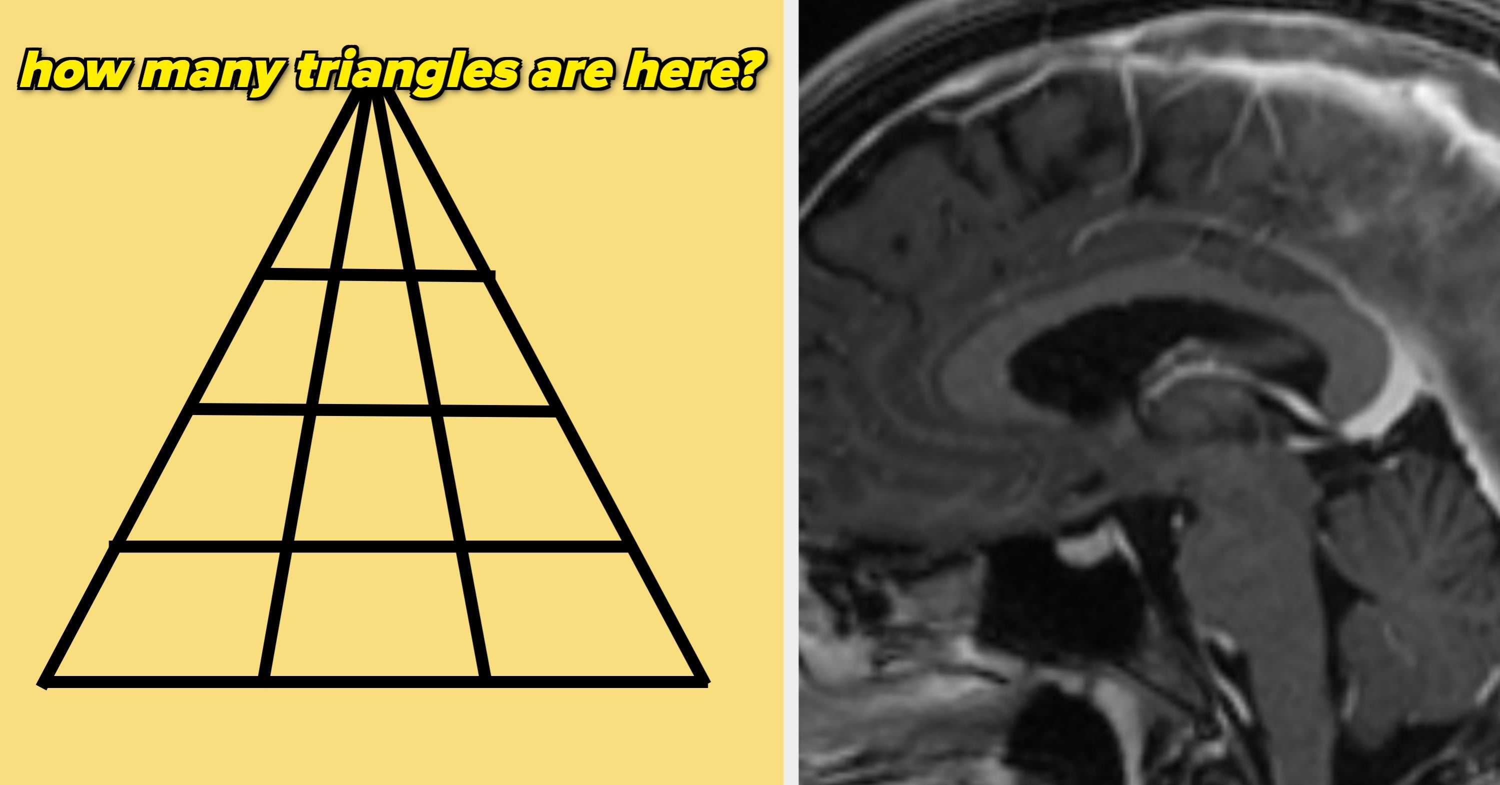 Pre-Quiz WARNING: This HARD IQ Test Will Reveal The Honest Truth Of How Fast Your Brain Processes Info