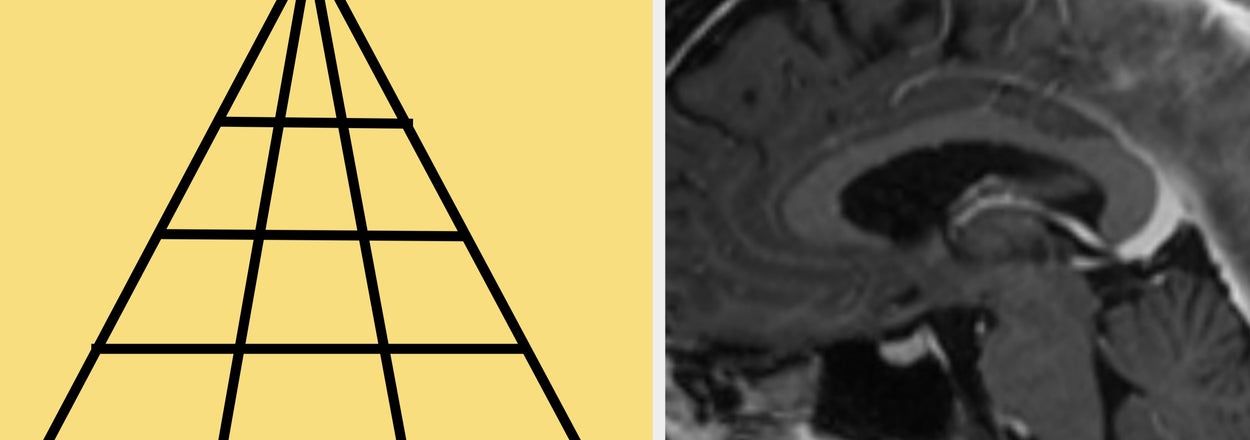 Can You Pass This (VERY HARD) Mixed Brain Test?