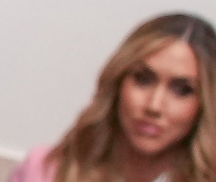 Nærbilde av Donald Trumps hår med et synlig gap i det