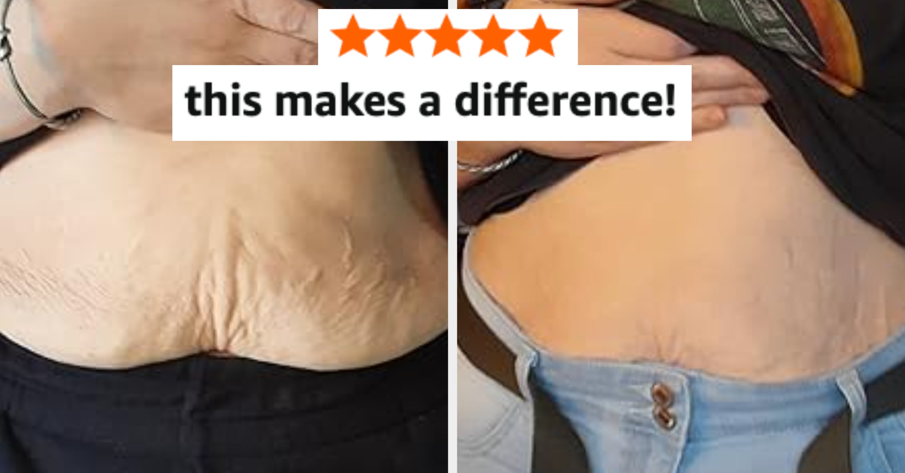 Reviewers Call These 32 Beauty Products “Magic” So It’s Probably Time We Start Listening