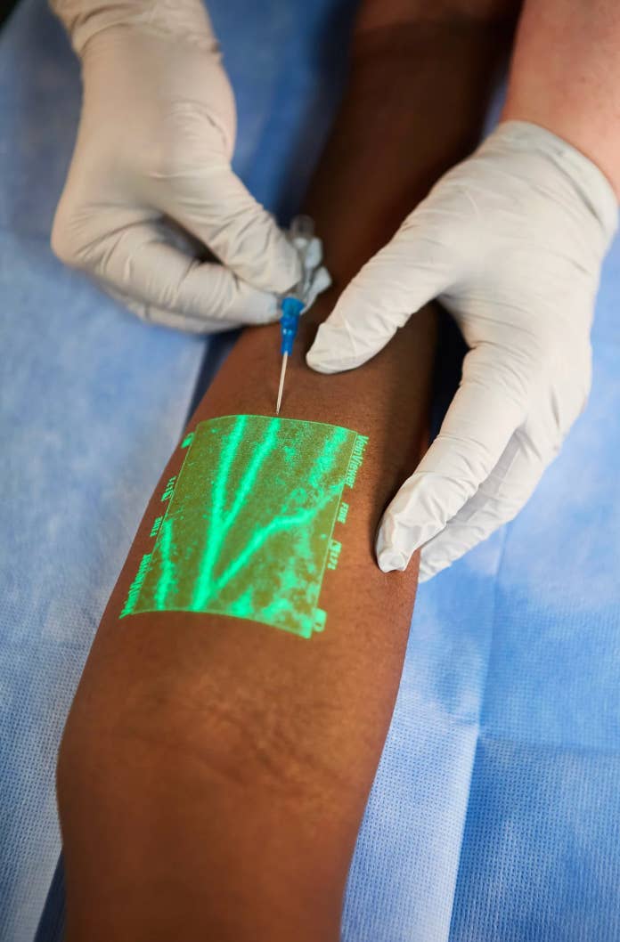 A aesculapian  nonrecreational  uses a vein finder to find    veins connected  a patient's limb  portion    preparing to insert a needle