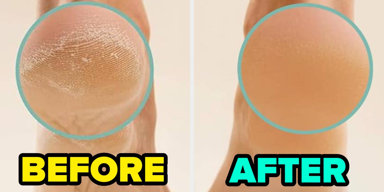 If You're Sick And Tired Of Buying Disappointing Products, Grab These 18 Personal Care Items That *Actually* Work