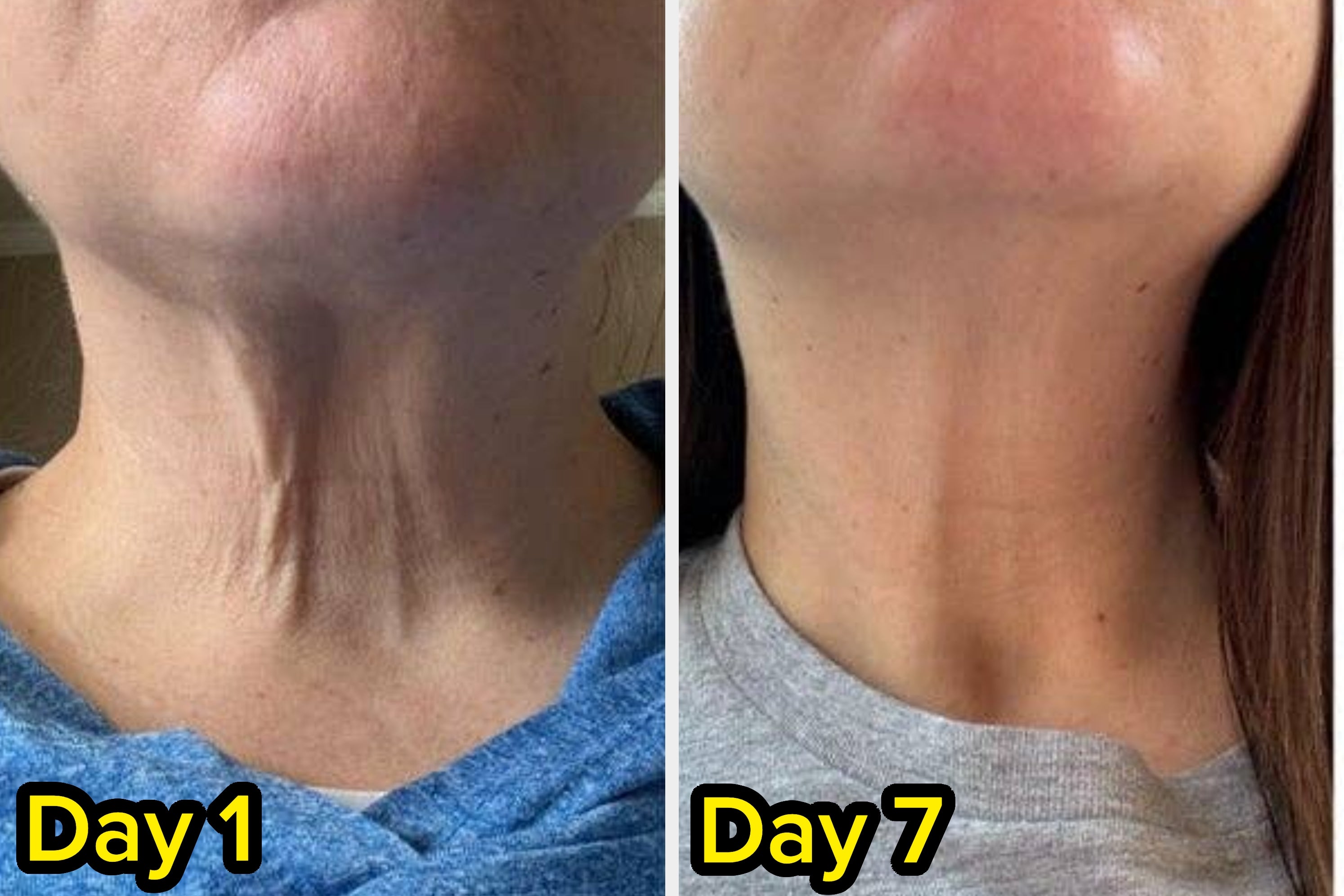 35 Beauty Products With Jaw-Dropping Before & After Photos From People Who Have Actually Used Them
