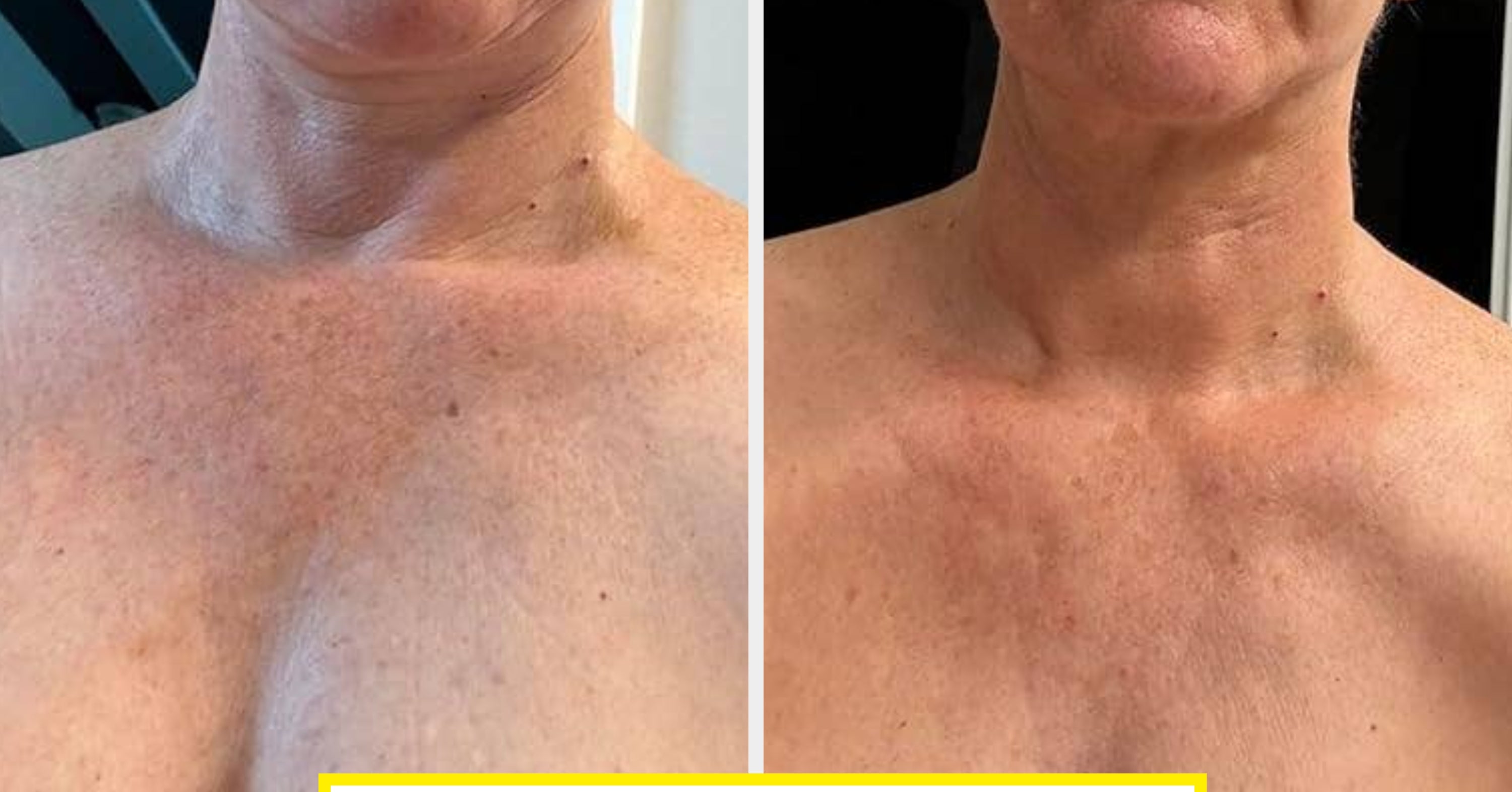 35 Beauty Products With Jaw-Dropping Before & After Photos From People Who Have Actually Used Them