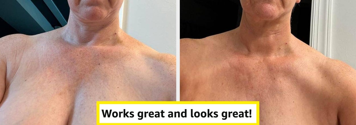 35 Beauty Products With Jaw-Dropping Before & After Photos From People Who Have Actually Used Them