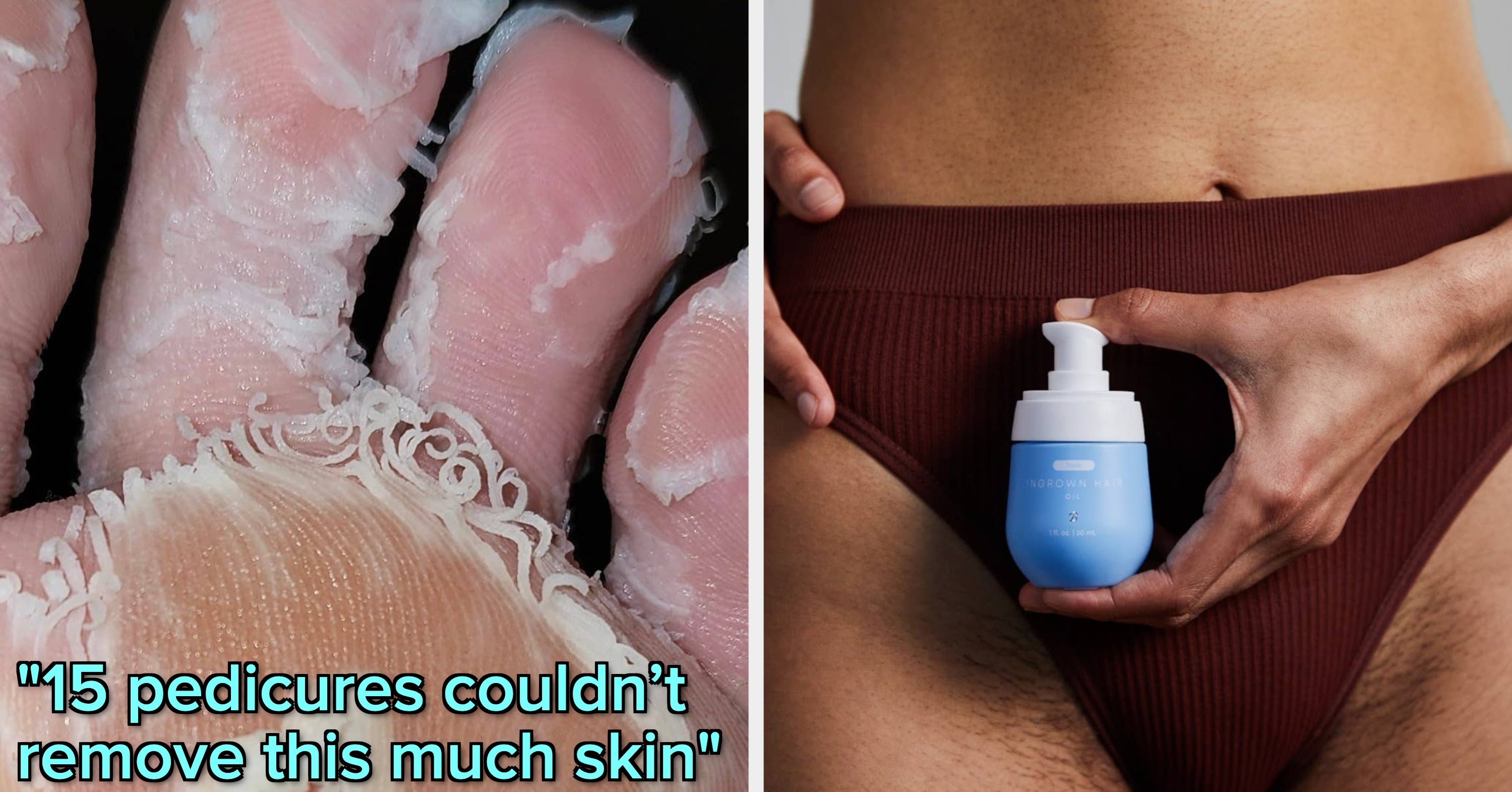 Say H-E-L-L-O To These 34 Products To Say B-Y-E To Any Annoying Body Issues You May Be Dealing With