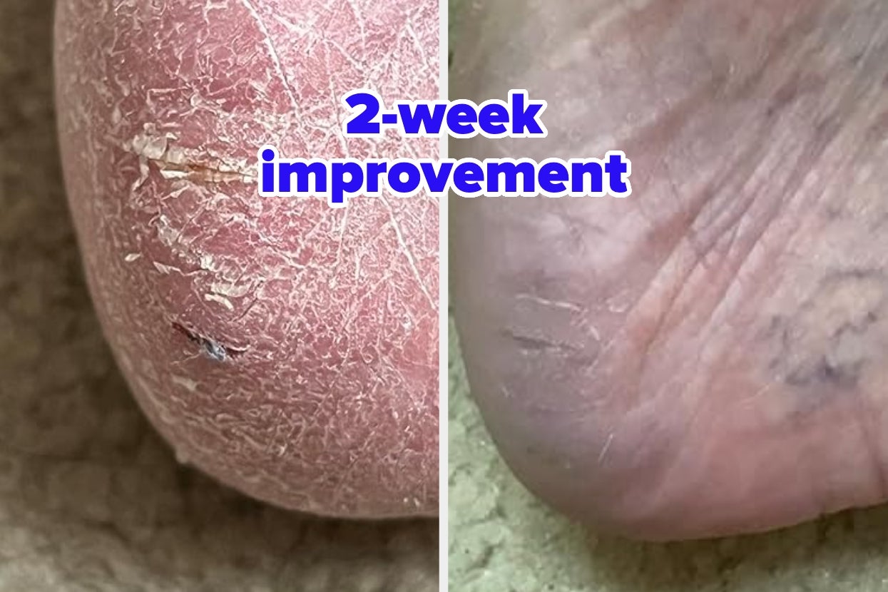 Those Kinda Embarrassing Problems? These 34 Things Will Help Solve 'Em