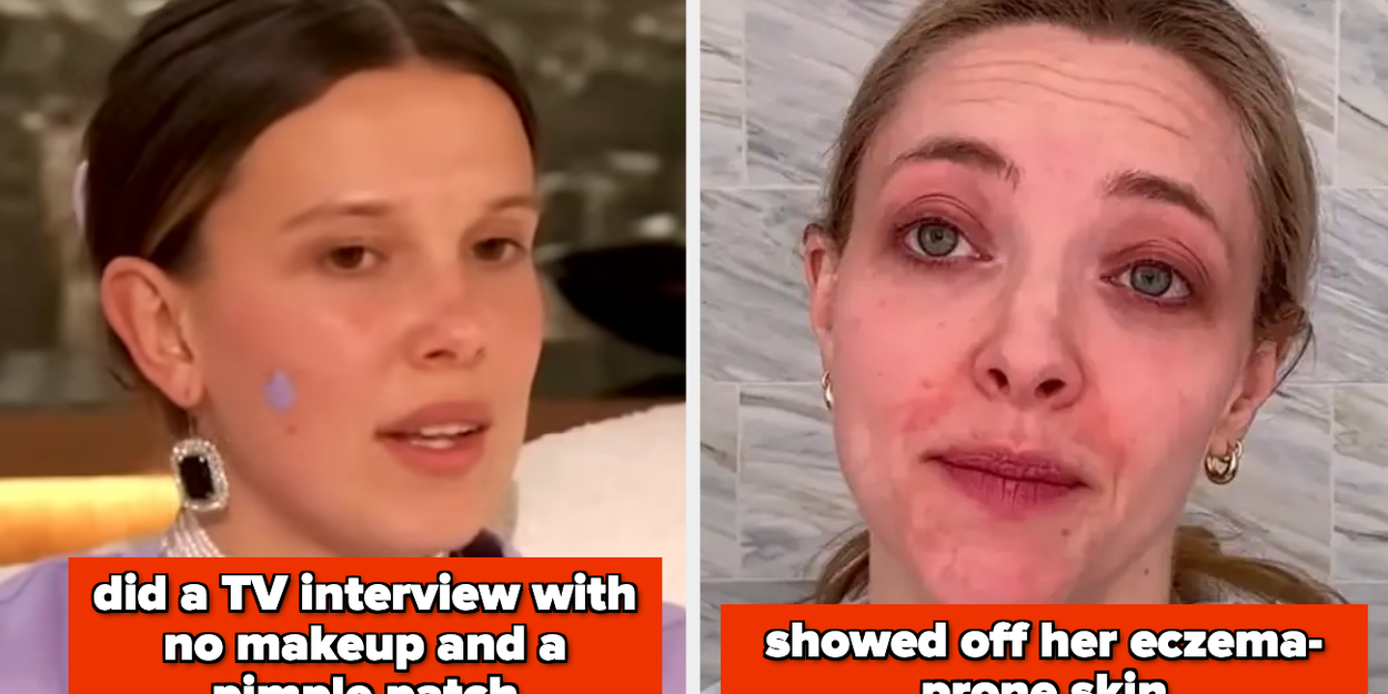 15 Celebs Who Went Makeup-Free: Photos, Reactions