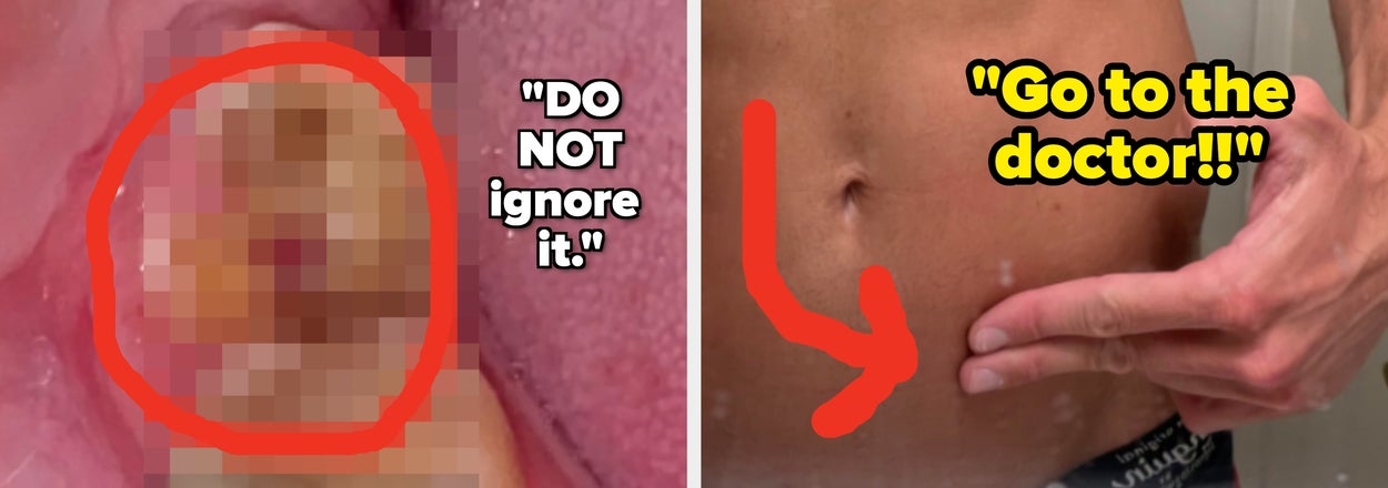 "I Thought It Was Just Stress": 17 People Shared The Early Symptoms They Regret Brushing Off