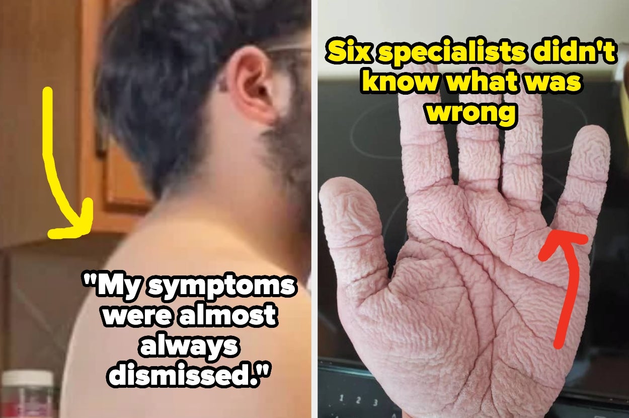 Man shows shoulder with text: "My symptoms were almost always dismissed." Hand with peeling skin and text: "Six specialists didn't know what was wrong."