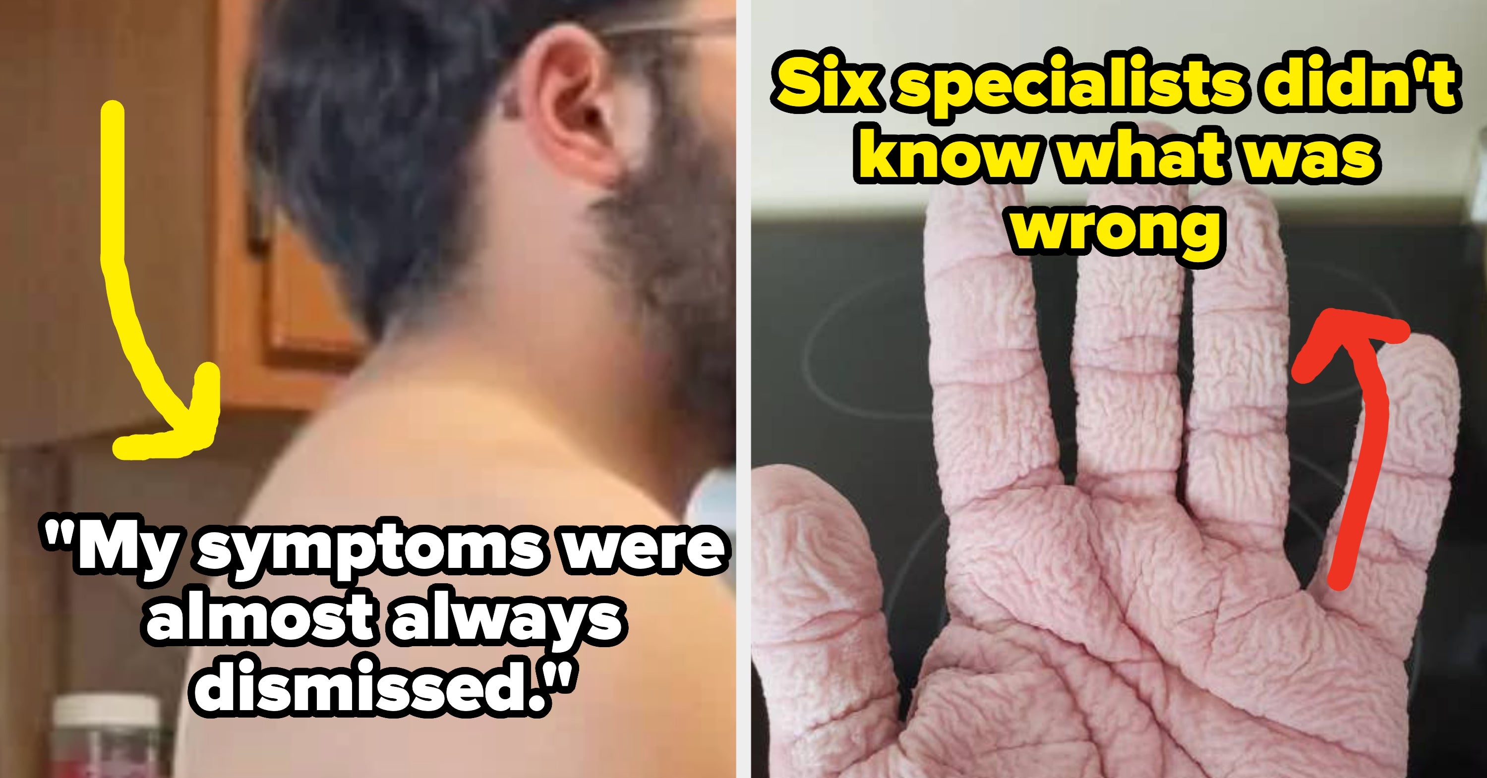 "I Would Have Died": People Are Sharing The Times Doctors Ignored Their Symptoms, And It's Infuriating