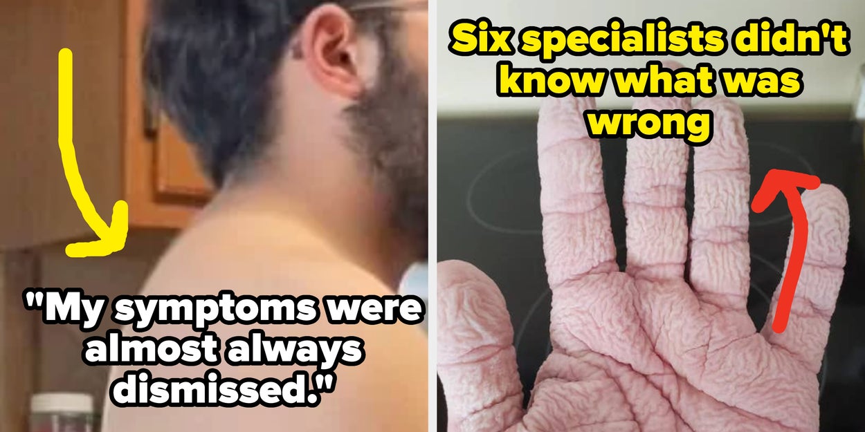 Patients Share Shocking Times Doctors Dismissed Their Symptoms