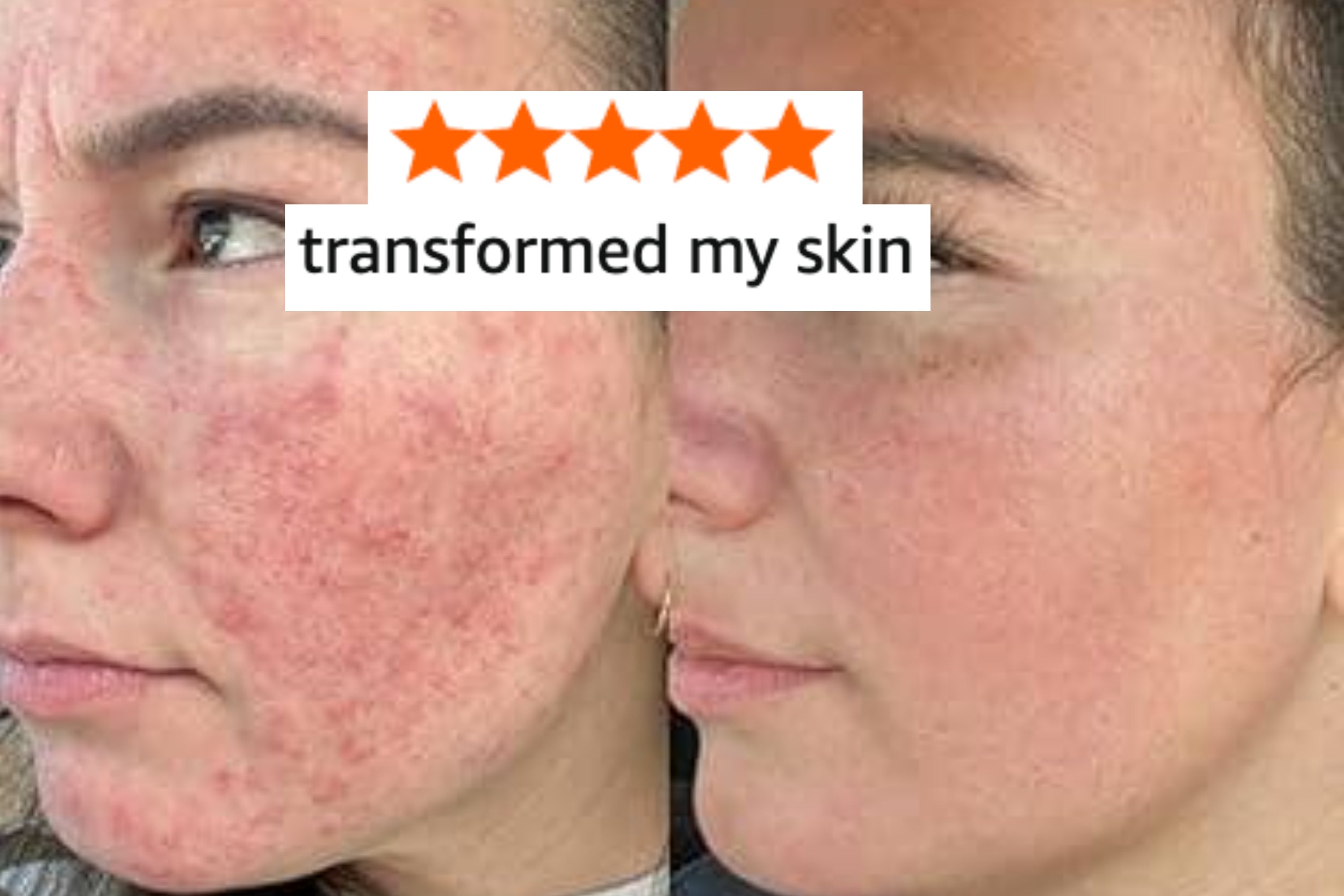 15 Gentle Cleansers For Sensitive Skin That Won’t Strip Your Face