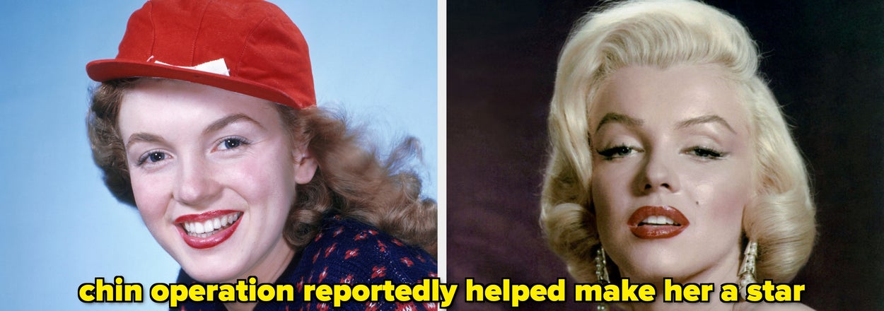 17 Old Hollywood Stars Before And After Cosmetic Surgery