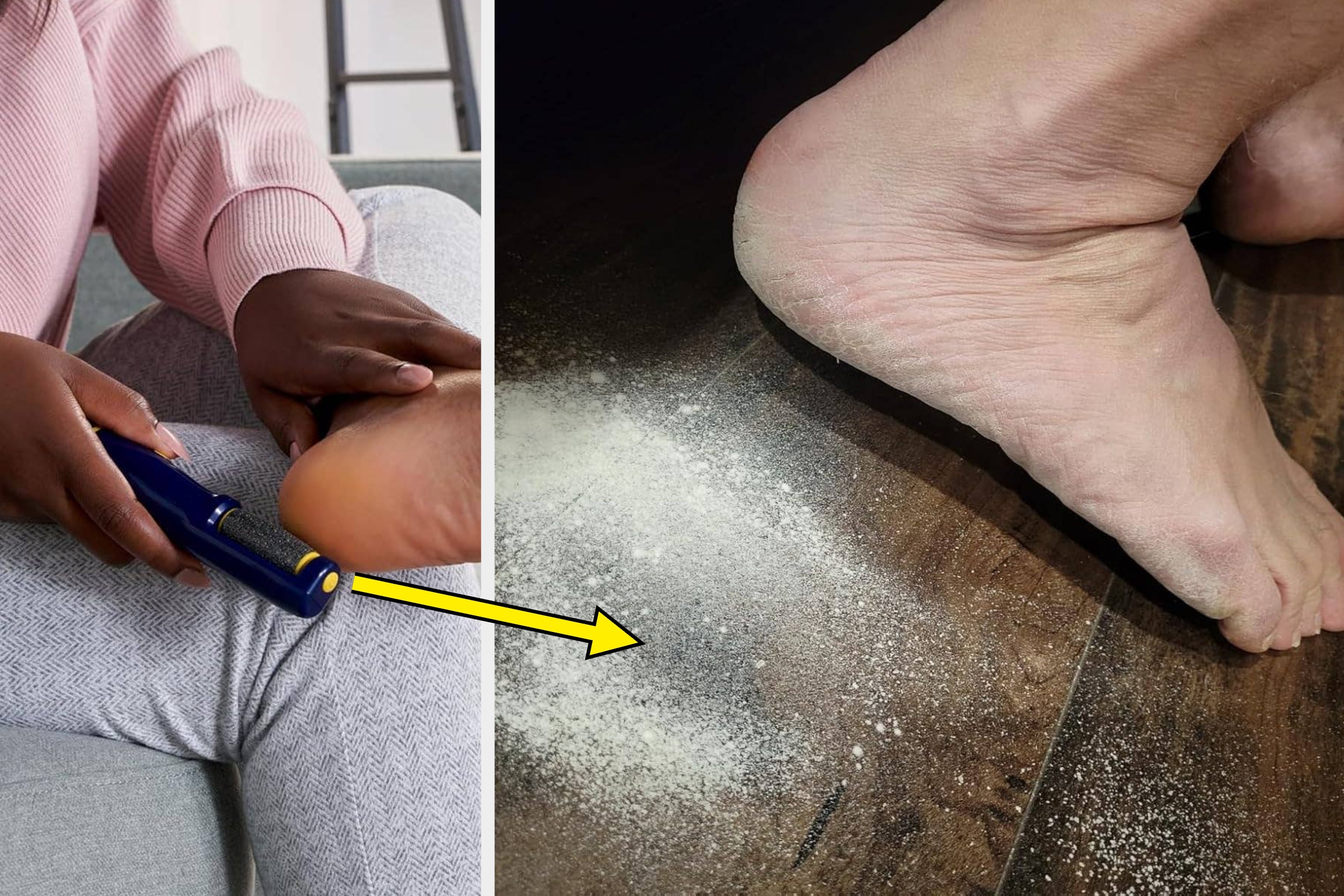 Just 29 Things To Treat Your Feet To Before Sandal Season