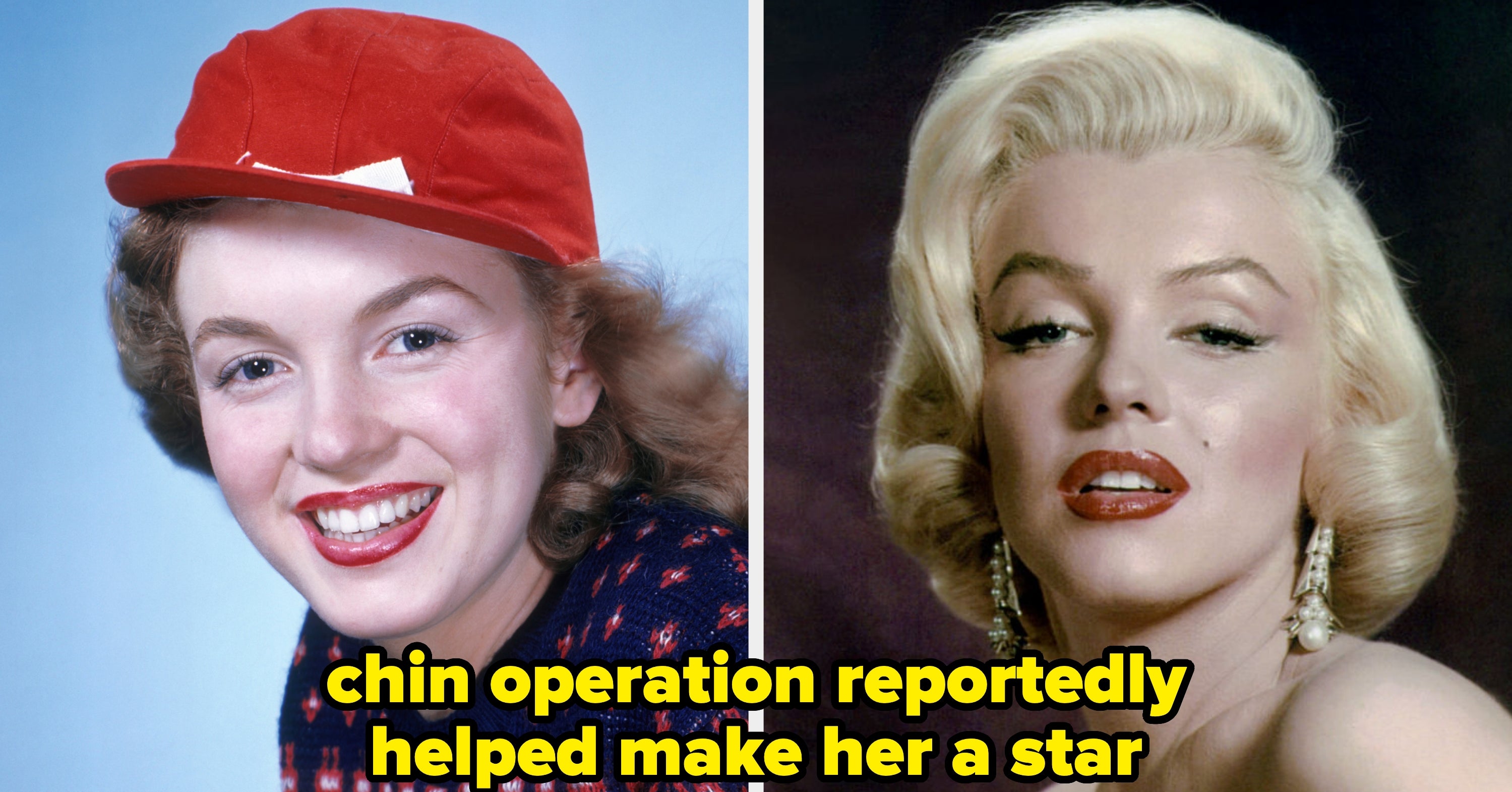 17 Old Hollywood Stars Before And After Cosmetic Surgery