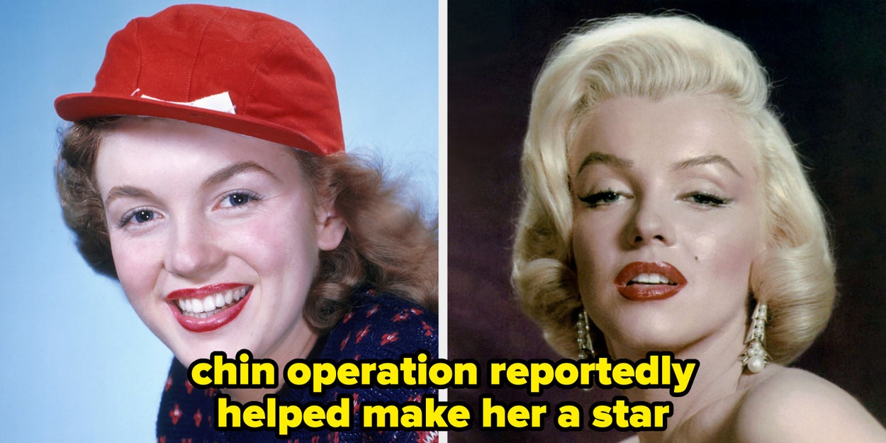 Old Hollywood Stars Before And After Plastic Surgery