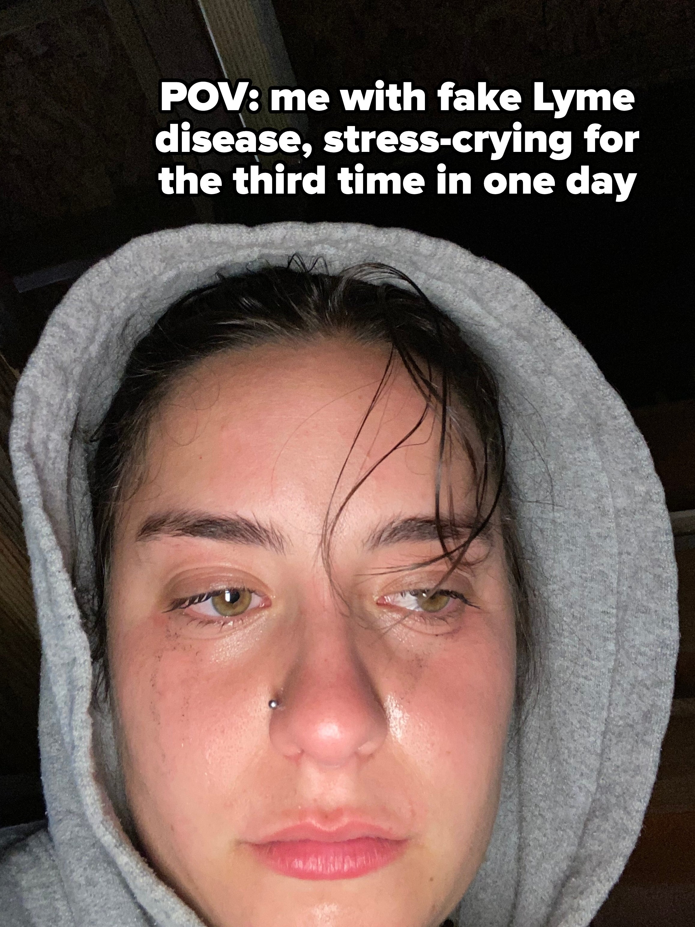 Young pistillate   with puffy eyes and chemoreceptor  ringing  wearing a hooded sweatshirt, crying