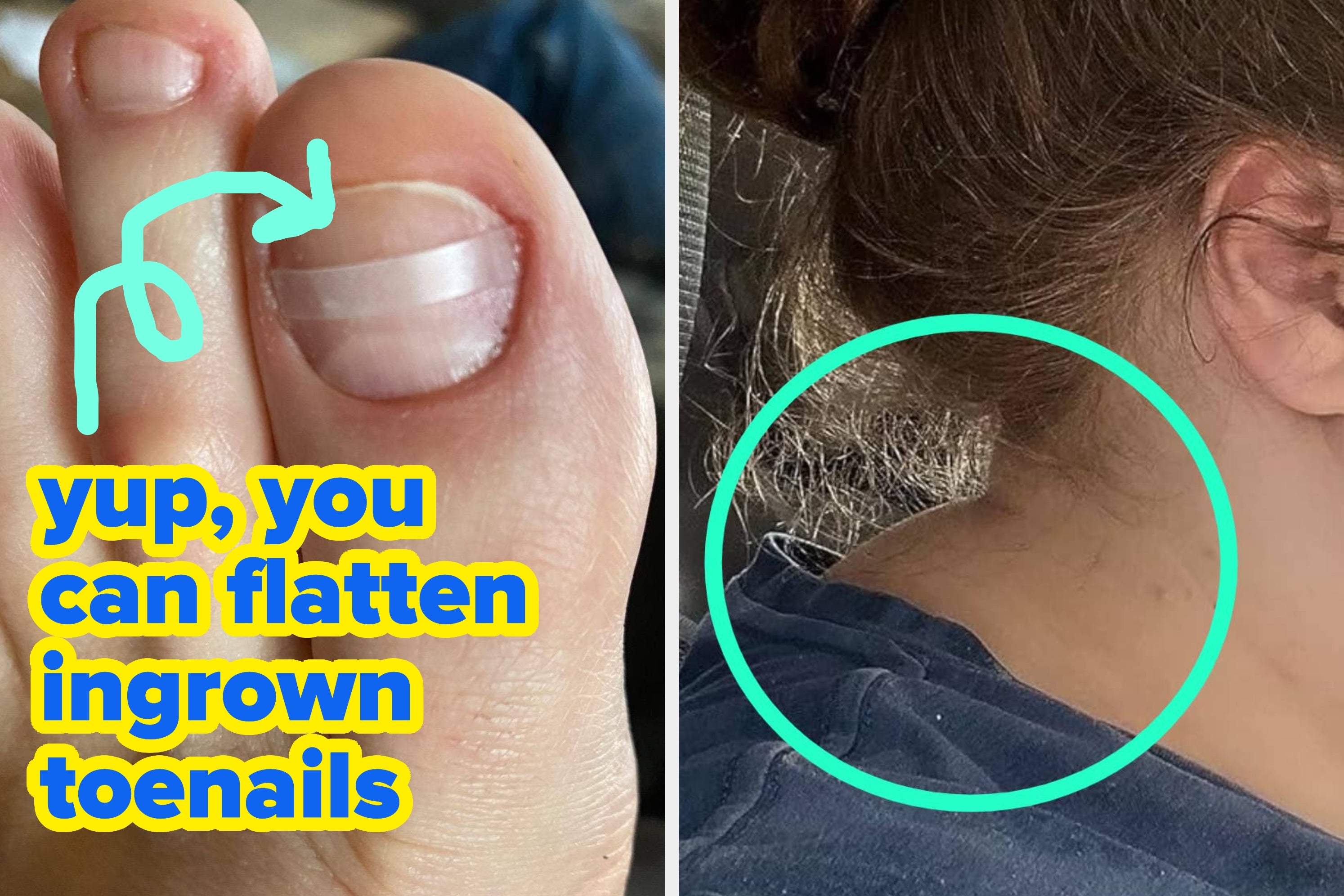 If You’ve Got Body-Related Problems You’d Rather Not Share With The Class, You Can Just Quietly Add These 36 Products To Cart