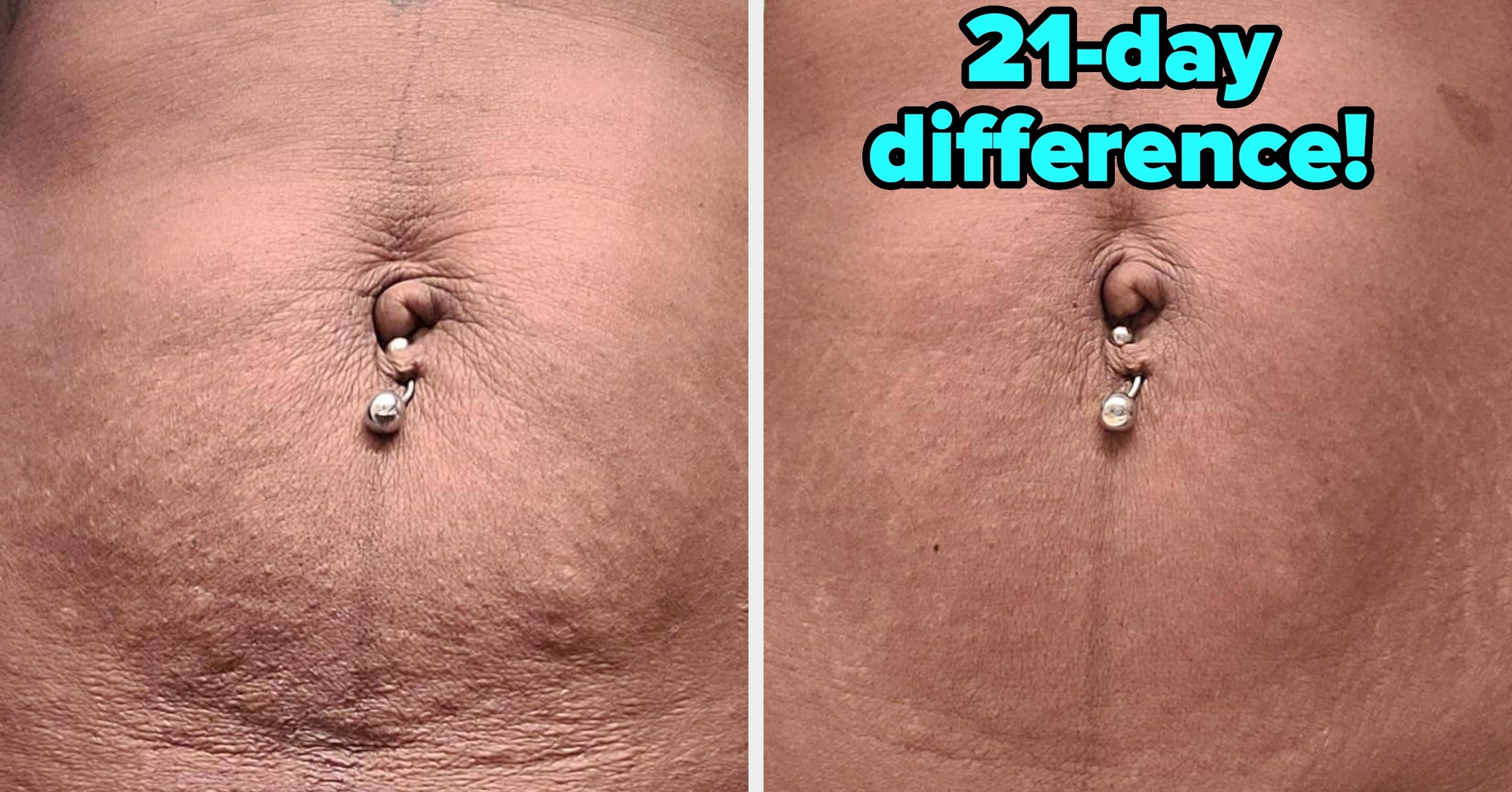 Adding These 38 Products To Your Cart Is A No-Brainer — The Results Are Just That Compelling