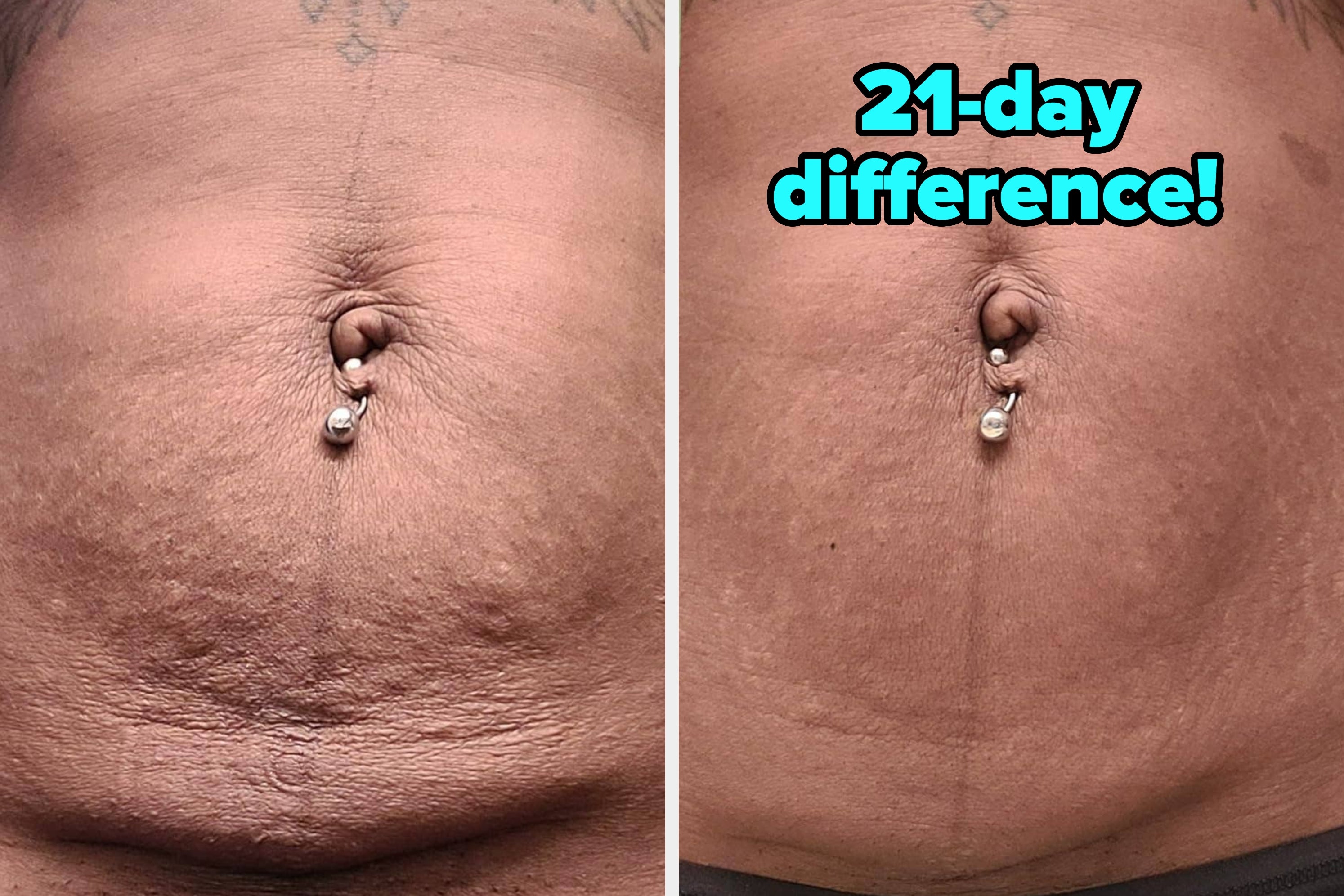 Adding These 38 Products To Your Cart Is A No-Brainer — The Results Are Just That Compelling