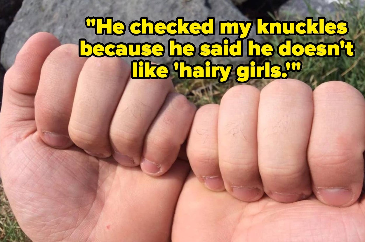 Two hands with visible knuckles, overlaid with text: "He checked my knuckles because he said he doesn't like 'hairy girls.'"