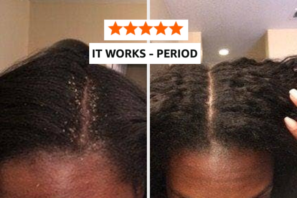 36 Products You May Want To Order Online If You're Someone Who Would Feel Awkward Buying 'Em In-Person