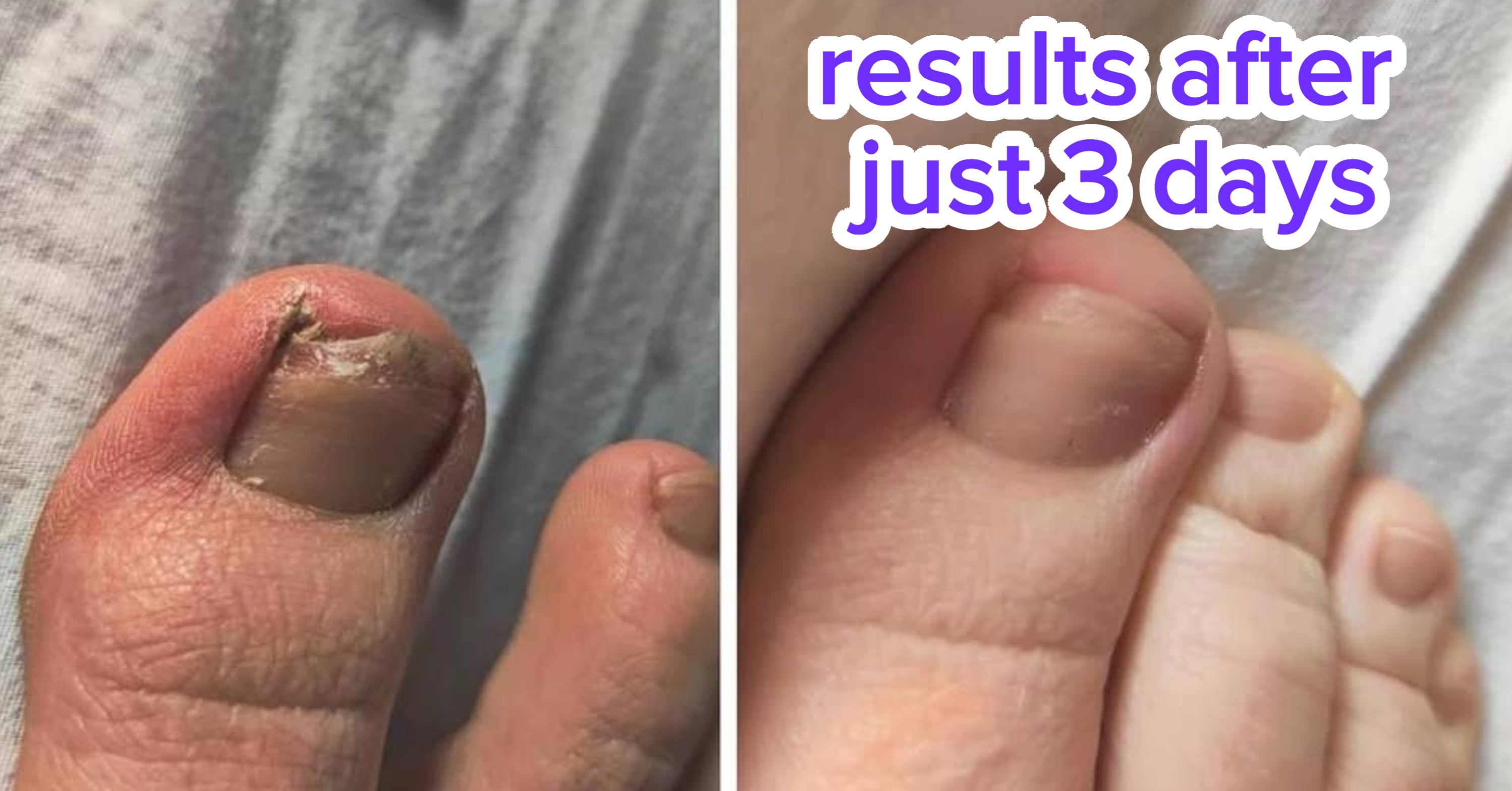 36 Products You May Want To Order Online If You're Someone Who Would Feel Awkward Buying 'Em In-Person