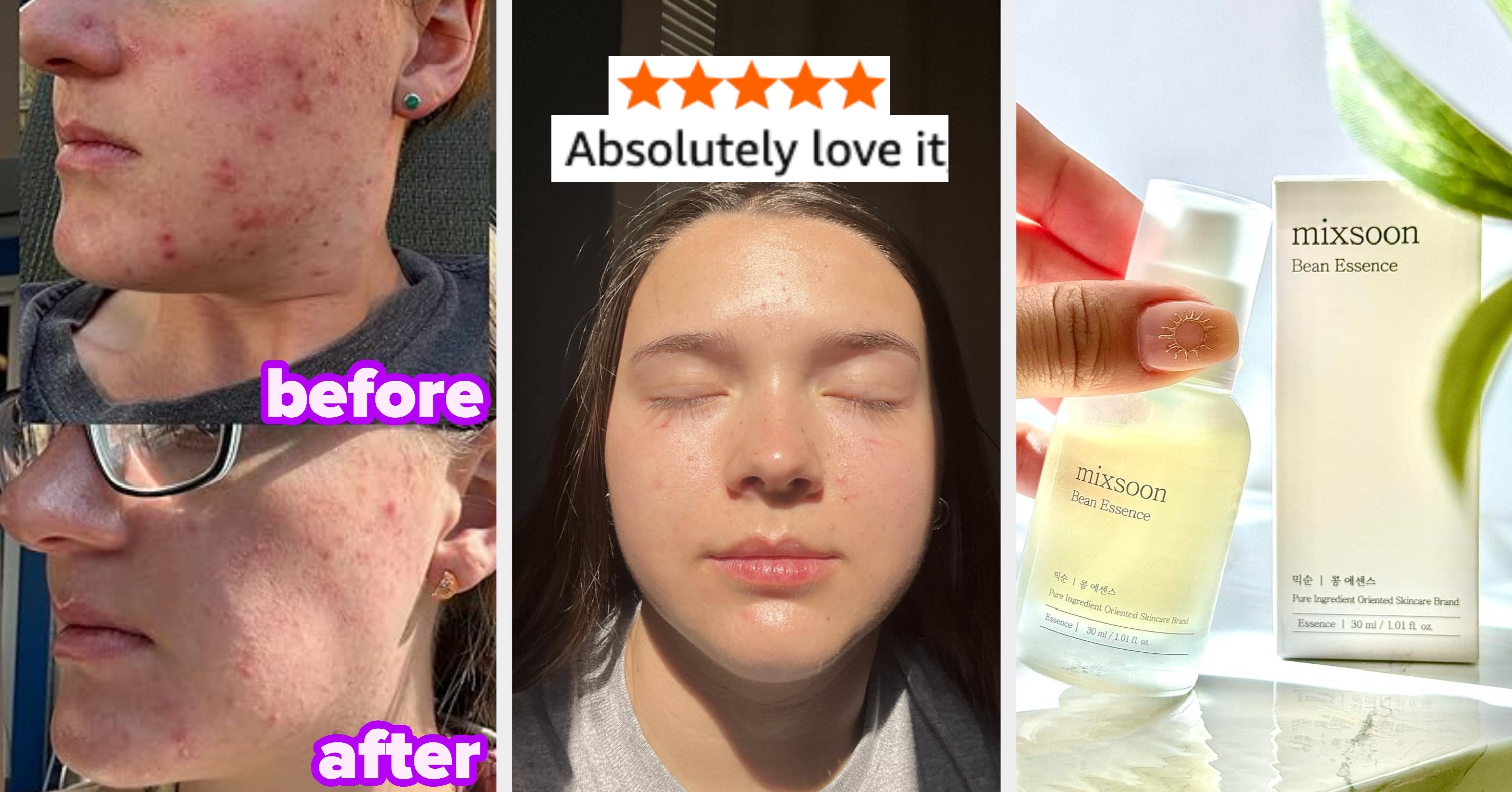 19 K-Beauty Products For Sensitive Skin That Are About To Become Your New Holy Grail