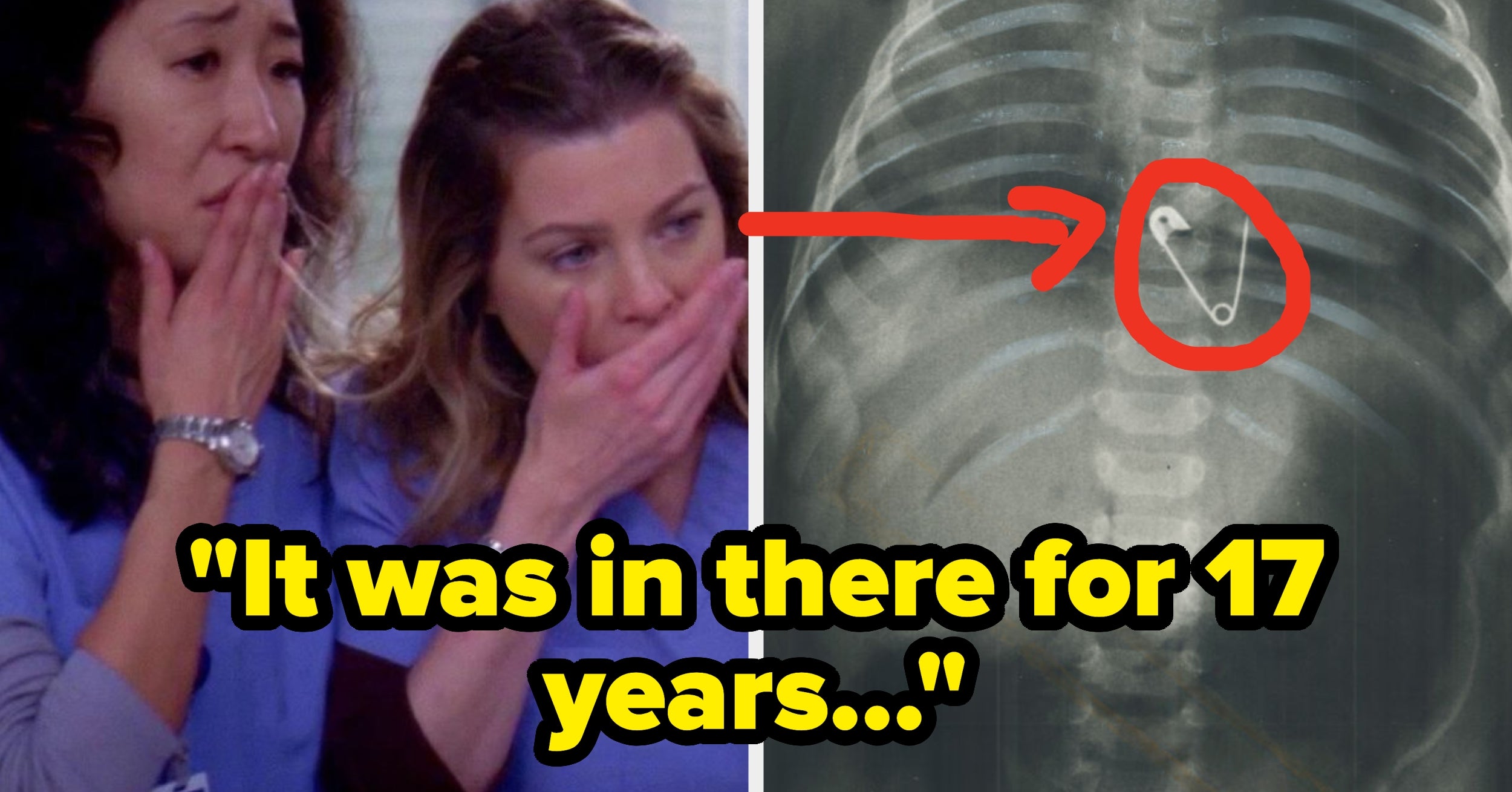 What's The Most Shocking Thing You've Seen In Surgery?
