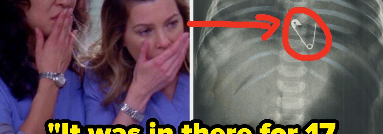 Medical Professionals, What's The Wildest Thing That's Ever Happened Mid-Surgery?