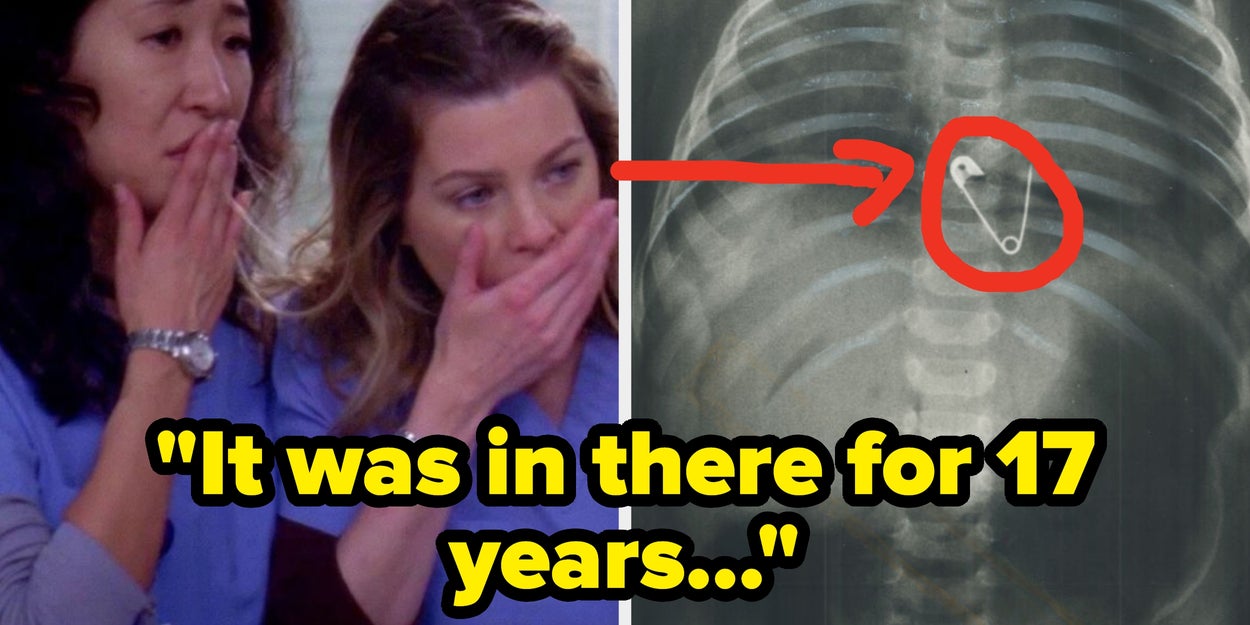 What's The Most Shocking Thing You've Seen In Surgery?