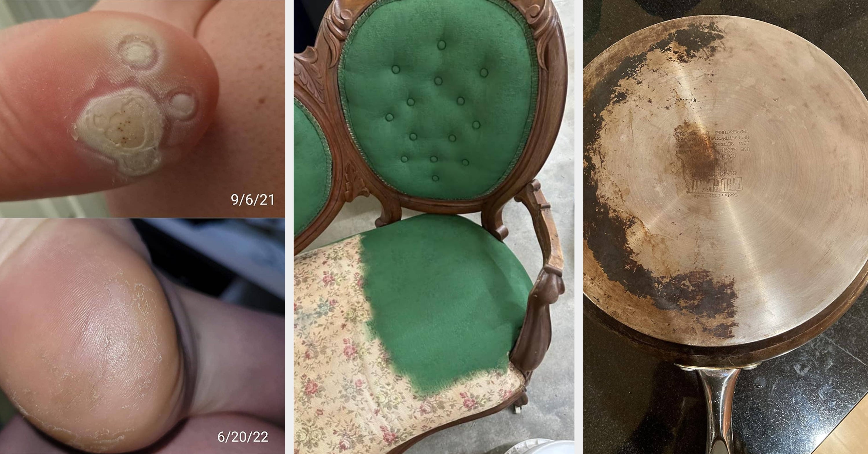 These 31 Products Have Impressive Results…Which Is Even More Impressive When You See How Things Started