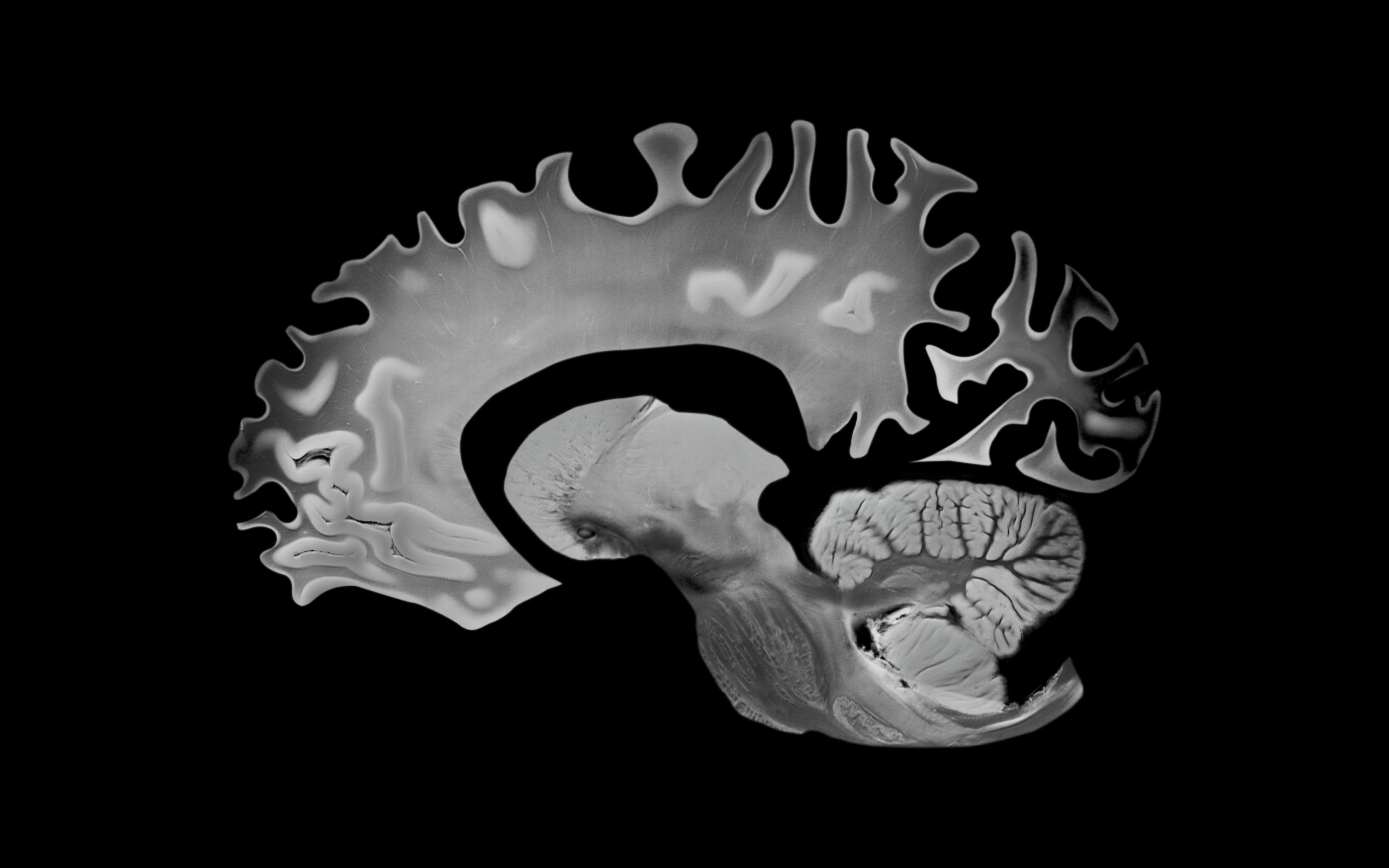 MRI scan of a quality  encephalon  showing elaborate  interior   structures and intricate patterns