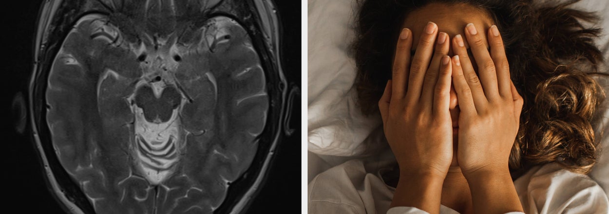 These 4 Sleep Problems Could Be Dementia Red Flags