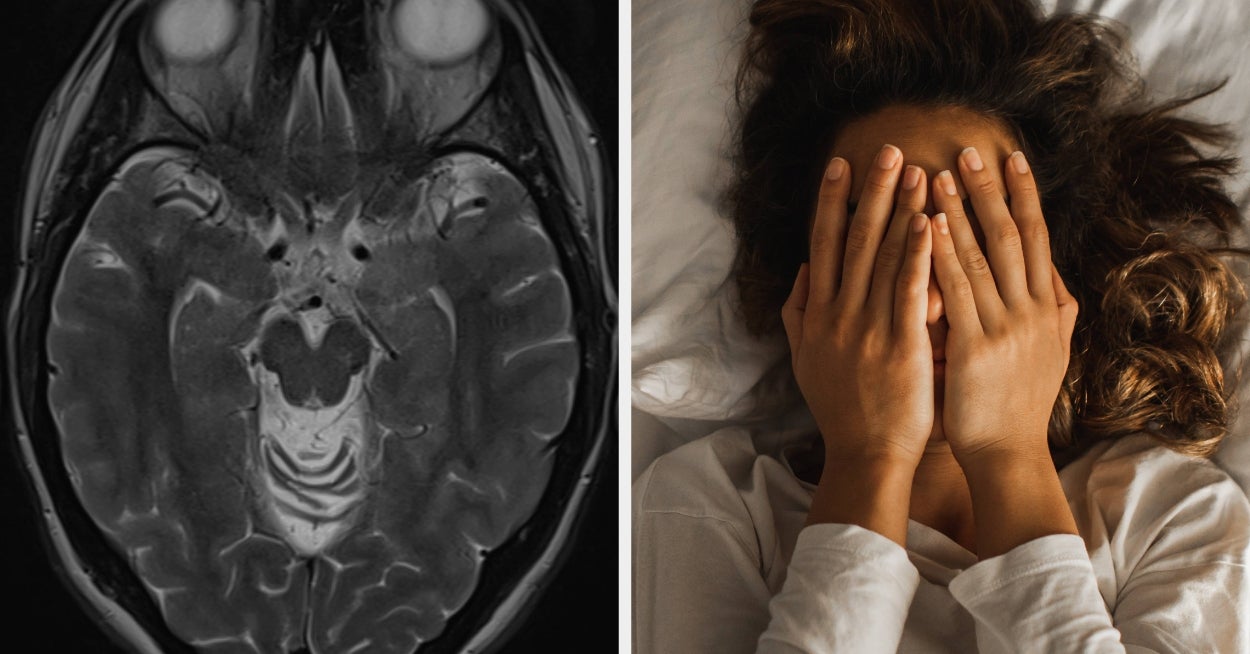 Neurologists Are Opening Up About Terrifying Sleep Problems That Might Be Early Warning Signs Of Dementia