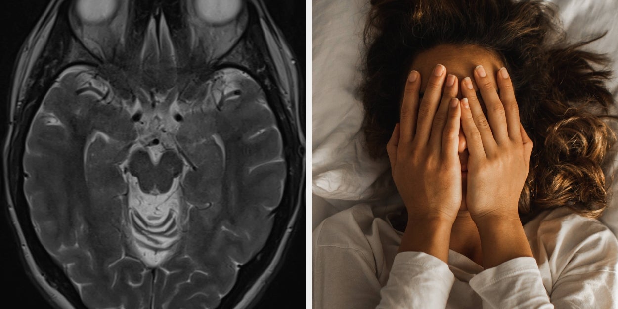 These 4 Sleep Problems Could Be Dementia Red Flags