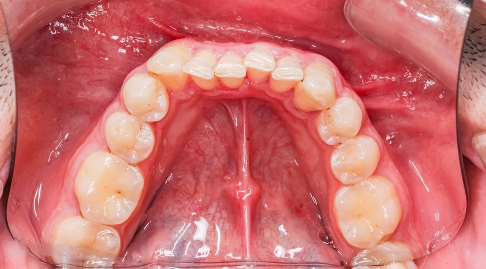 Post image 18