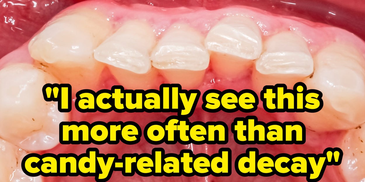 This Common Snack Is A Major Cause Of Cavities