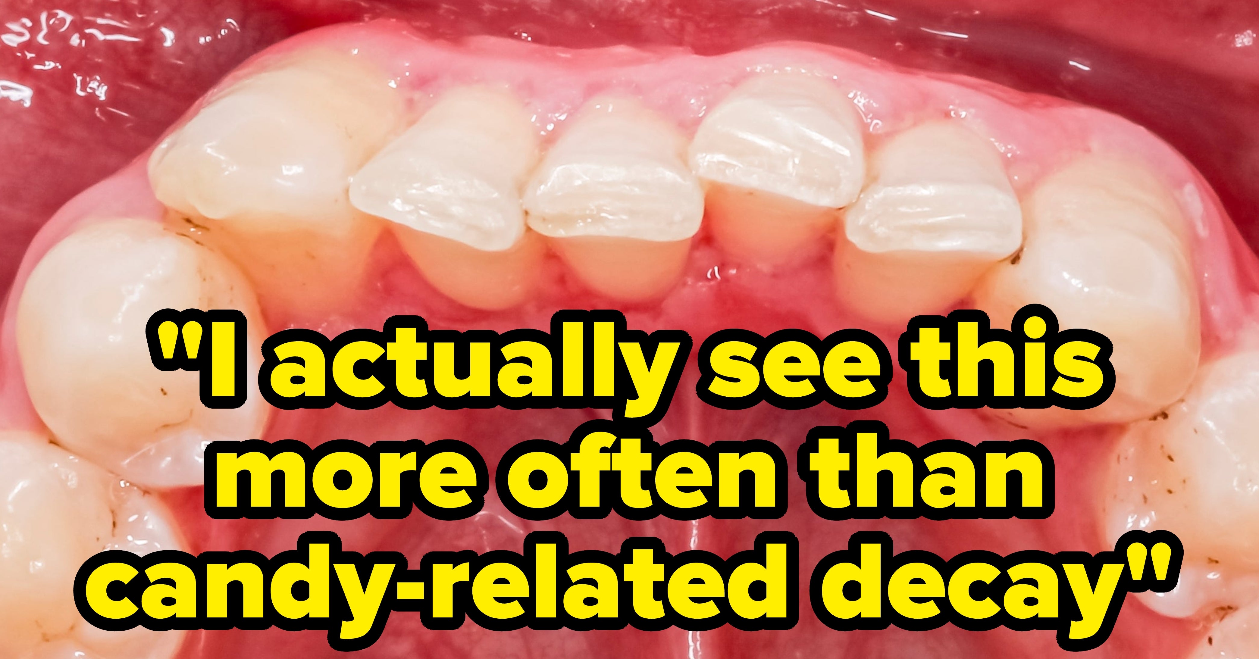 This Cheesy Snack Is A Sneaky Contributor To Cavities In Both Kids And Adults. Dentists Are Discussing Why, And How To Mitigate It