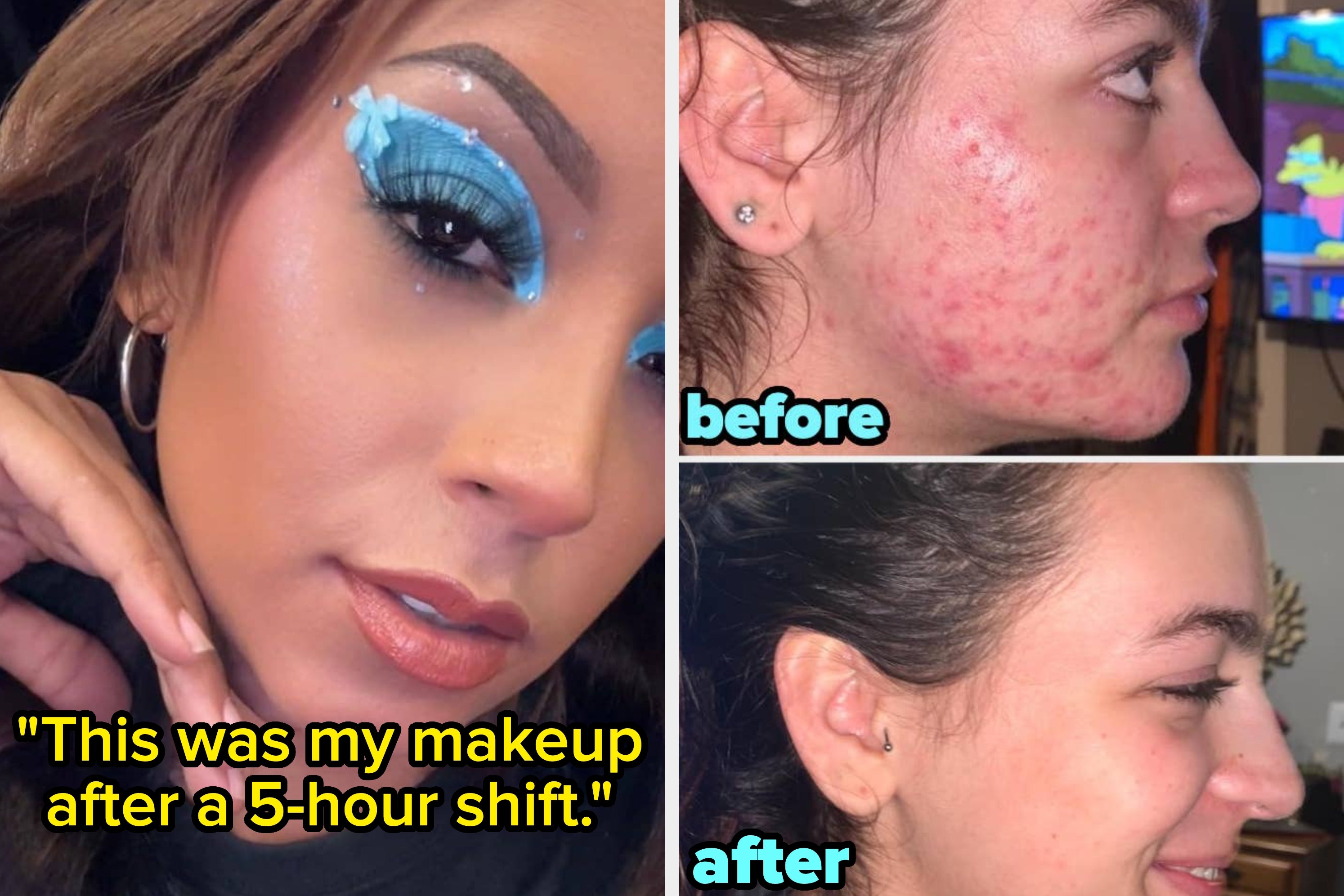 33 Korean Beauty Products With Results That’ll Stun You Into Silence For A Few Seconds