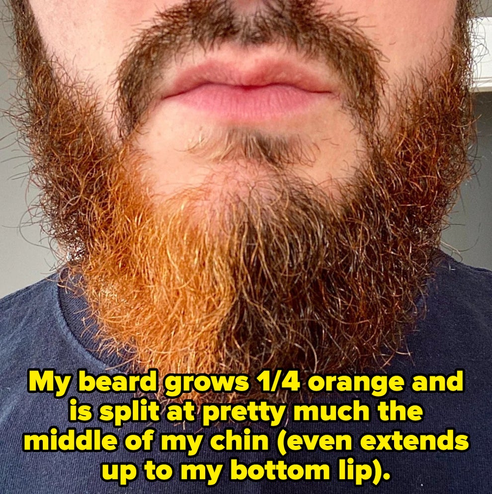 Post image 13