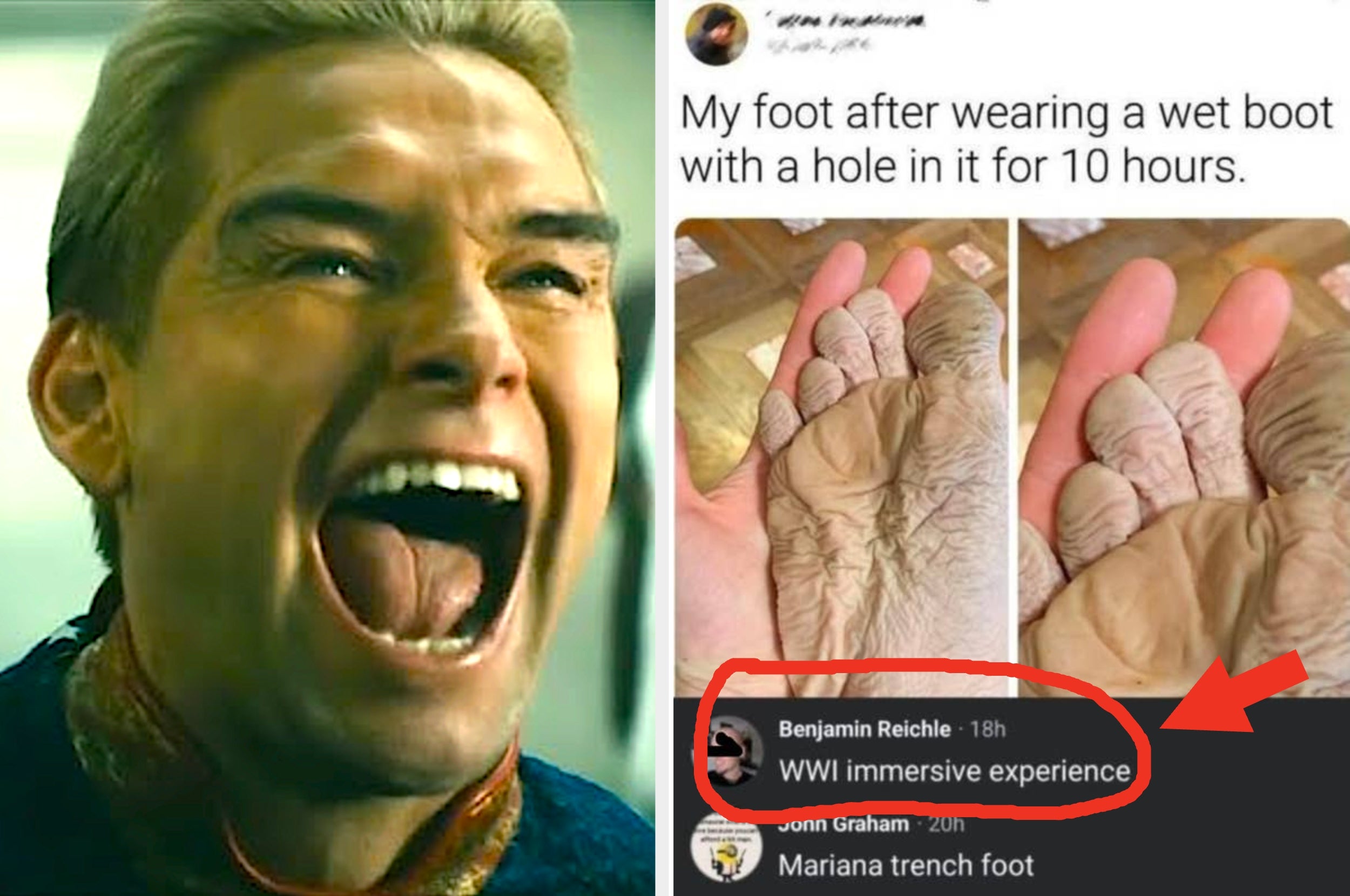 Meme with a person laughing on the left. On the right, an image of wrinkled foot skin after wearing a wet boot, with a comment comparing it to WWI