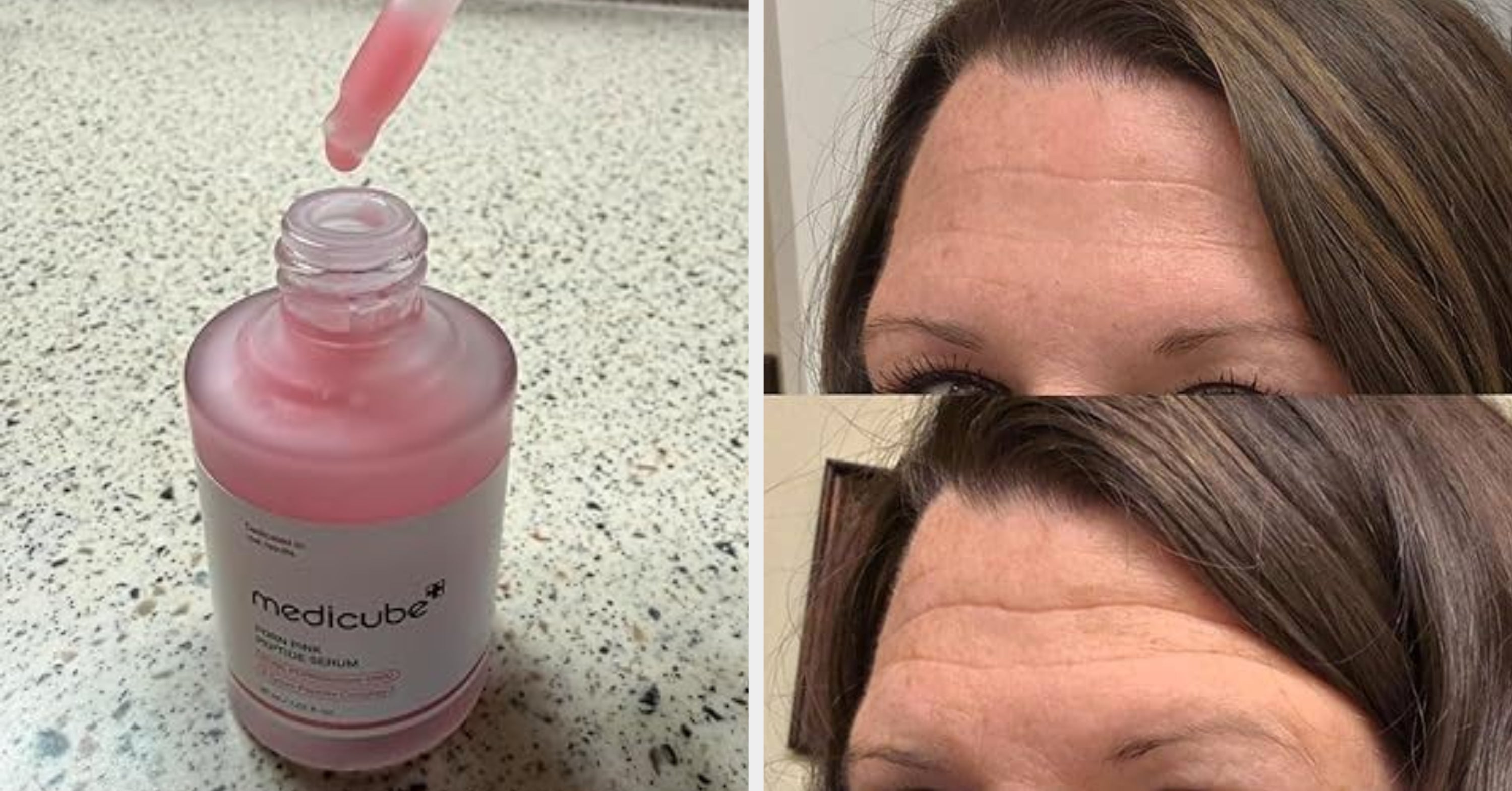 27 Skincare Products From Amazon That Basically Work Just Like Magic