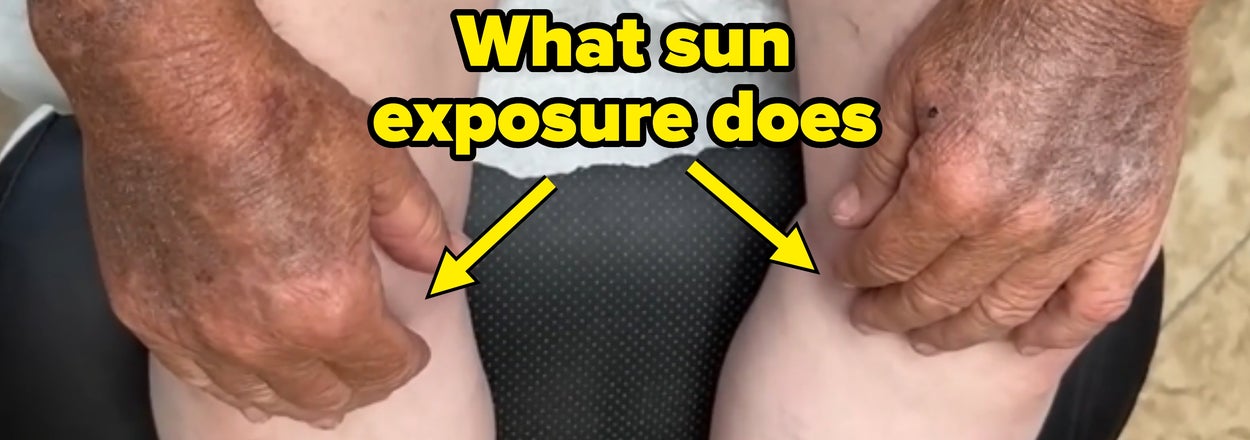 66 Shocking, Fascinating, And Straight-Up Bonkers Photos Of The Human Body
